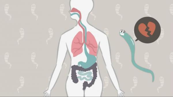 你知不知道寄生蟲(chóng)感染如何影響神經(jīng)認(rèn)知？